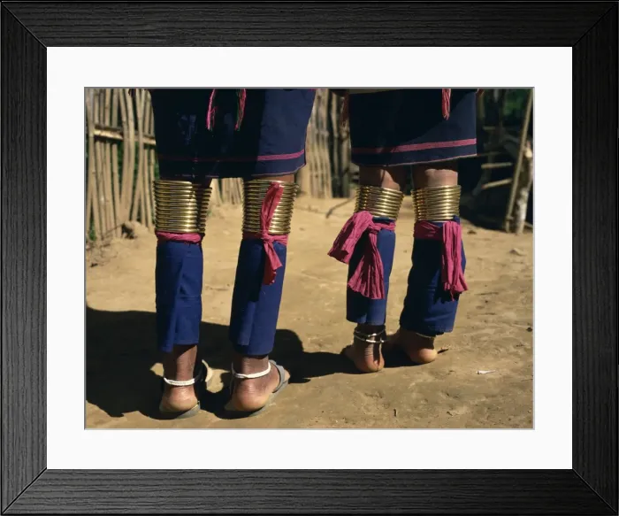 Framed Print : Close-up of legs covered in cotton fabric and rings Framed Print : Close-up of legs covered in cotton fabric and rings