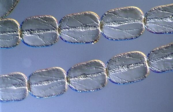 Light Micrograph (LM) of cells from a hair on the stamen of the common spiderwort