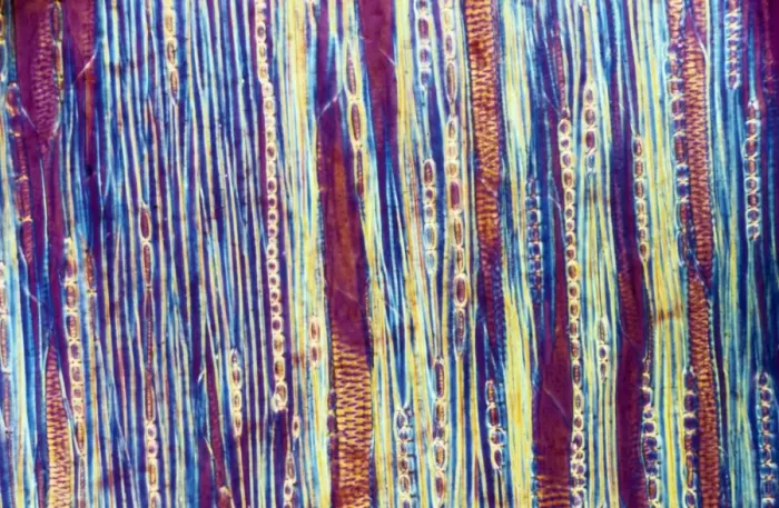 Framed Print : Light Micrograph (LM) of a longitudinal section showing xylem elements of a Ribes sp Framed Print : Light Micrograph (LM) of a longitudinal section showing xylem elements of a Ribes sp