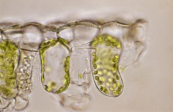Light Micrograph (LM) of a plant cell chloroplasts, the site where photosynthesis takes place