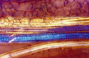 Light Micrograph (LM) of a longitudinal section of stem showing xylem elements of Crown of Thorns