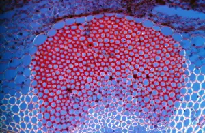 Light Micrograph (LM) of a transverse section showing Sclerenchyma Ground Tissue in Helianthus stem
